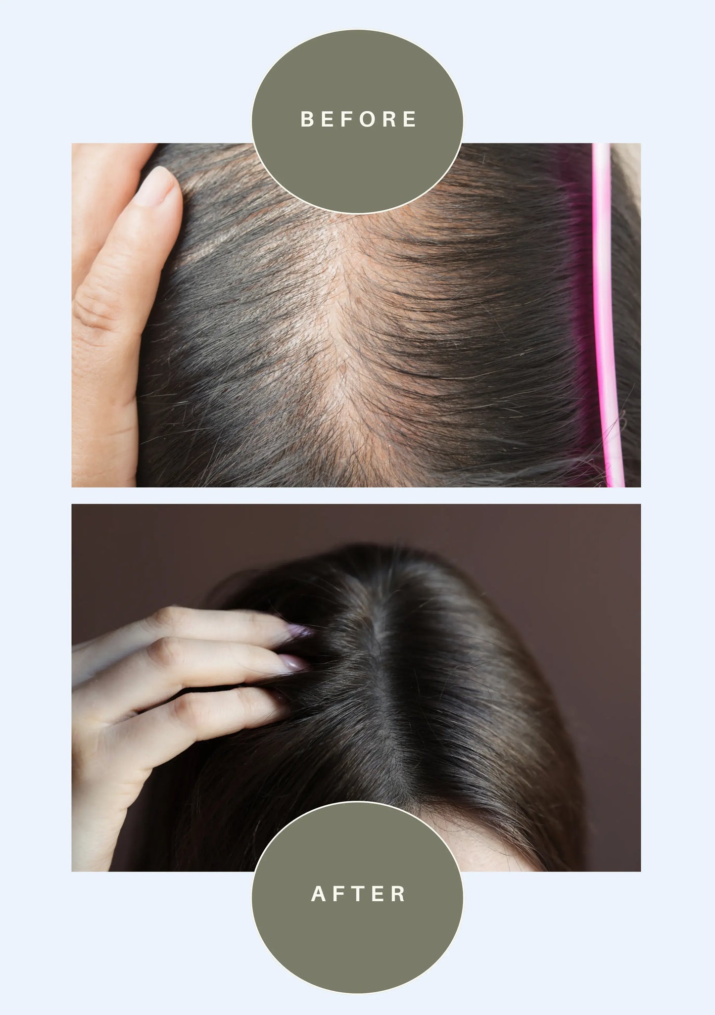 ROOT PRO Hair Growth Oil & Serum Combo for Stronger, Thicker & Healthier Hair